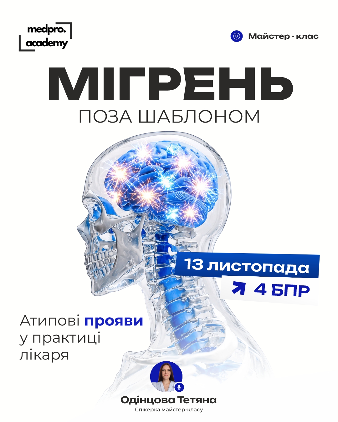 3Мігрень поза шаблоном атипові прояви у практиці лікаря